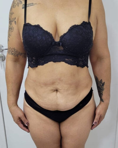 Protocolo de Emgrecimento